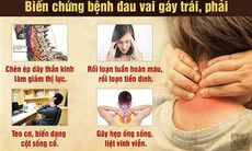 Đau vai gáy là bệnh gì? Nguyên nhân, triệu chứng và cách khắc phục