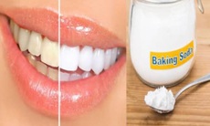 Chuyên gia tư vấn: Dùng Baking soda làm trắng răng  và chăm sóc răng miệng- Những lầm tưởng tai hại