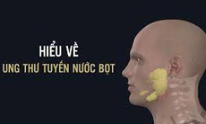 Ung thư tuyến nước bọt:  Dấu hiệu nhận biết và các phương pháp điều trị