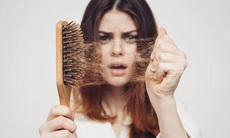 7 nguyên nhân khiến mái tóc xơ xác 