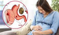 Đau dạ dày khi mang thai, nguyên nhân và cách xử trí 