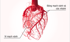 Rối loạn chức năng vi mạch - Nguyên nhân quan trọng gây thiếu máu cơ tim