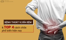 Top 4 cách chữa thoát vị đĩa đệm phổ biến hiện nay