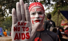 VIDEO: Ca nhiễm HIV đầu tiên trên thế giới được phát hiện vào năm nào?