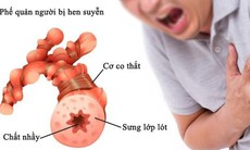 Khoảng 4 triệu người Việt mắc hen phế quản, cần nâng cao năng lực điều trị và chủ động kiểm soát bệnh