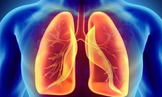 7 thay đổi lối sống và điều chỉnh chế độ ăn uống để có lá phổi khỏe mạnh