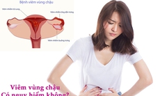 Bệnh viêm vùng chậu điều trị như thế nào?