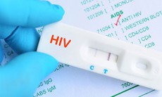 Bạn có biết: Xét nghiệm HIV hoàn toàn miễn phí

