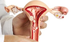 Dính buồng tử cung có thể gây vô sinh