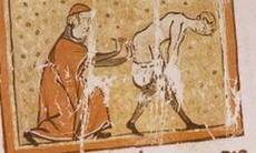 Thời cổ xưa con người từng dùng đỉa, than nóng để chữa bệnh trĩ