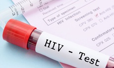 Sau phơi nhiễm với HIV, khi nào nên đi xét nghiệm?