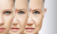 Các bệnh về da hay gặp ở phụ nữ tuổi ngoài 40 và cách chăm sóc
