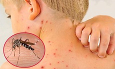 Top 7 bệnh viện tin cậy điều trị sốt xuất huyết ở Bình Định