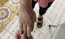Diễn biến mới nhất vụ bé trai 8 tuổi bị bạo hành ở Hải Phòng