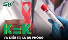 K = K và điều trị là dự phòng HIV/AIDS