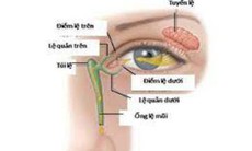 Tắc ống lệ mũi ở trẻ sơ sinh, cách nhận biết và điều trị