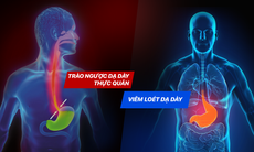 Lưu ý khi sử dụng thuốc dạ dày để chữa trào ngược