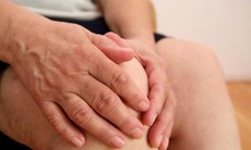 Hạt tophi ở người bệnh gout và những ảnh hưởng cần lưu ý