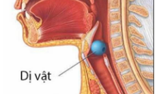 Cụ bà tím tái, hôn mê sau khi ăn hoa quả