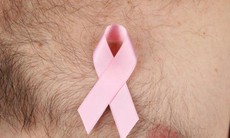 Ung thư vú nam: Nguyên nhân và triệu chứng lâm sàng