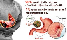 Hỗ trợ điều trị HP dạ dày bằng Đông y
