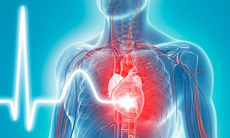COVID-19 ảnh hưởng đến tim mạch thế nào?