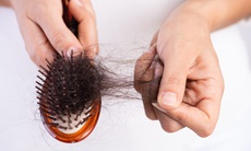 Bổ sung biotin có ngăn ngừa rụng tóc?