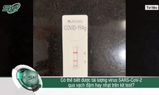 Có thể biết được tải lượng virus SARS-CoV-2 qua vạch đậm hay nhạt trên kit test?