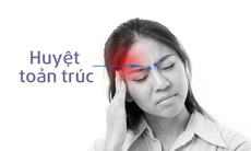 Day huyệt trị nhức mỏi mắt 