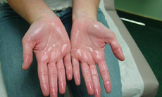 Xịt thảo dược khử mùi tin cậy cứu cánh cho mùa hè sắp đến