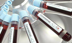 Mối liên quan giữa nhóm máu và nguy cơ mắc COVID-19 trầm trọng