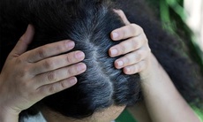 Thủ thuật ngăn ngừa tóc bạc sớm