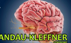 Trẻ động kinh bỗng nhiên không nghe, không nói: Cẩn thận Hội chứng Landau - Kleffner