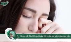 Dị ứng mắt: Không chữa kịp thời có thể gây biến chứng nguy hiểm