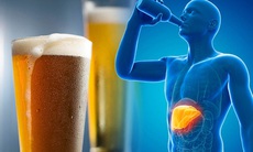 Uống rượu bia nhiều gây hại thế nào cho gan?