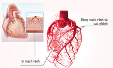 Hỗ trợ cải thiện tình trạng đau thắt ngực, thiếu máu cơ tim với chiết xuất từ thông Dahurian