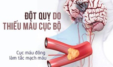 Gia tăng nguy cơ đột quỵ ở người cao tuổi sử dụng thuốc chống nôn