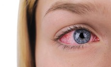 Tuyến lệ 3D giúp chữa bệnh khô mắt?