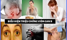 Viêm gan B - Nguyên nhân, triệu chứng và cách điều trị khoa học