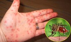  Làm sao biết chính xác sắp khỏi bệnh sốt xuất huyết?