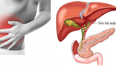 Chứng đầy hơi nguyên nhân và cách khắc phục