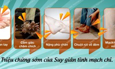 Chuột rút về đêm - Dấu hiệu của suy giãn tĩnh mạch