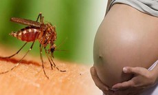 Phụ nữ mang thai có truyền virus Dengue gây bệnh sốt xuất huyết cho con không?