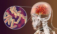 Vaccine ngừa bệnh phế cầu khuẩn xâm lấn ở trẻ em