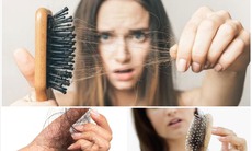 Hạn chế tình trạng rụng tóc ở phụ nữ tuổi trung niên