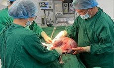 Cắt khối u buồng trứng khổng lồ nặng 10kg giải thoát cho cô gái trẻ

