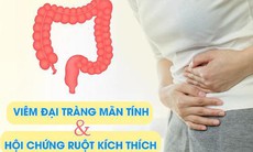 Bí quyết của Mỹ hỗ trợ bệnh đại tràng