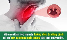 Viêm amidan hốc mủ: Điều trị càng muộn càng nguy hiểm