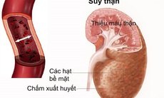 Điều trị suy thận mạn như thế nào?