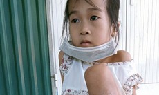 Không tiền điều trị, bé gái dân tộc Dao bị rắn độc cắn có nguy cơ mất chân vĩnh viễn